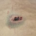 Rover Insurance Dog Bite: Safeguard Your Furry Friend